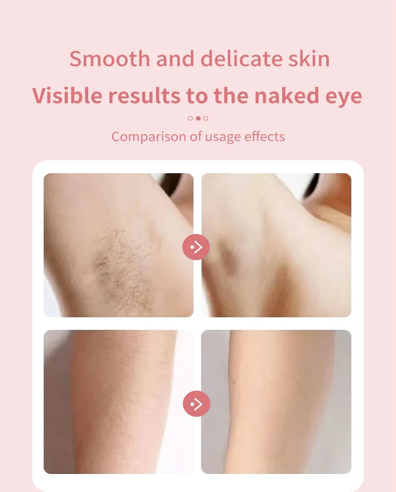 KMCE New Design Painless Hair Trimmer Facial Depiladora Epilator Hair Removal Device Waterproof Bikini Lady Shaver for Women