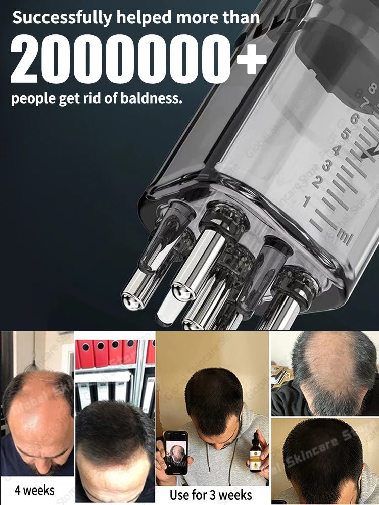 Head massager relieves head fatigue and relaxes scalp essence oil nourishing liquid hair care massage - anavora