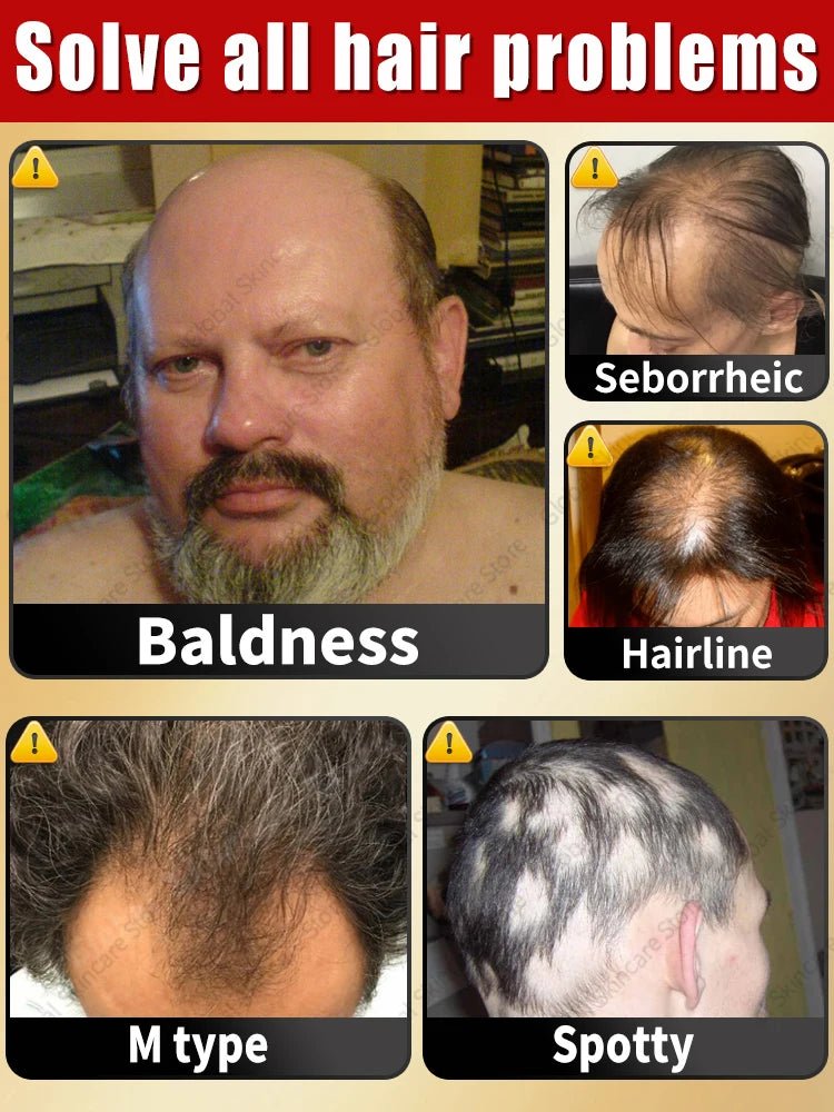 Head massager relieves head fatigue and relaxes scalp essence oil nourishing liquid hair care massage - anavora