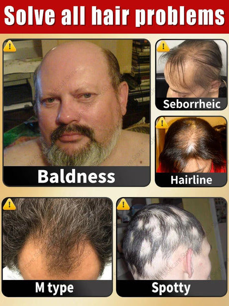 Head massager relieves head fatigue and relaxes scalp essence oil nourishing liquid hair care massage - anavora