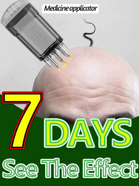 Head massager relieves head fatigue and relaxes scalp essence oil nourishing liquid hair care massage - anavora