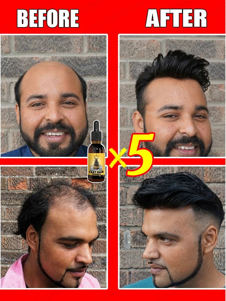 Natural essence to protect your hair, body hair, beard, and chest hair! Gentle and non - irritating. - anavora