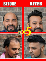 Natural essence to protect your hair, body hair, beard, and chest hair! Gentle and non - irritating. - anavora